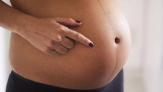 Почему появляется полоска на животе при беременности и можно ли с ней бороться